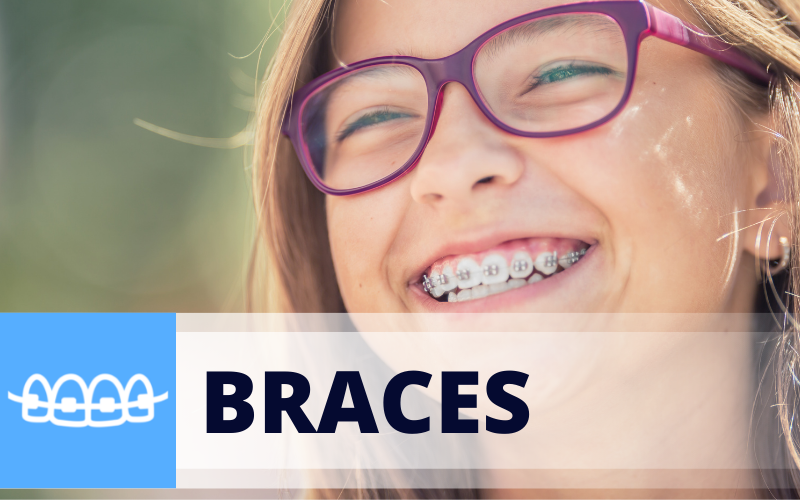 Dr-Avila-Braces